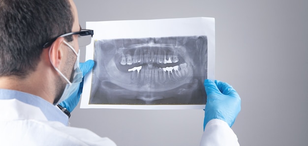 Kaukasischer Arzt, der am Röntgenbild der Zähne hält.