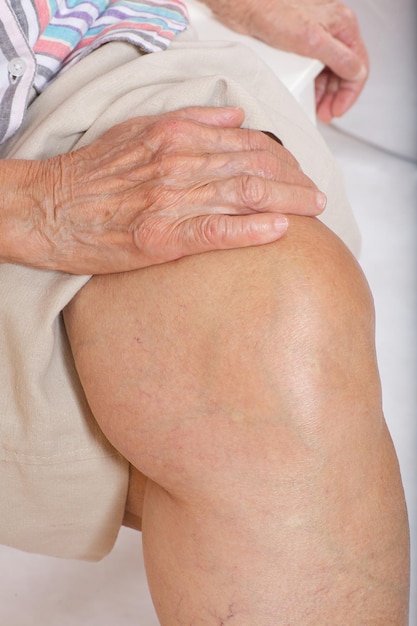 Knie einer älteren Frau zwischen 70 und 80 Jahren.Nahaufnahme