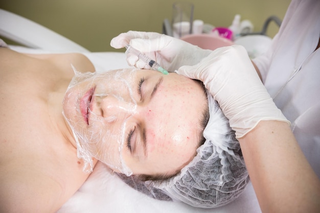 Kosmetisches Verfahren der Mesotherapie-Injektionsmarkierungen auf einer Stirn