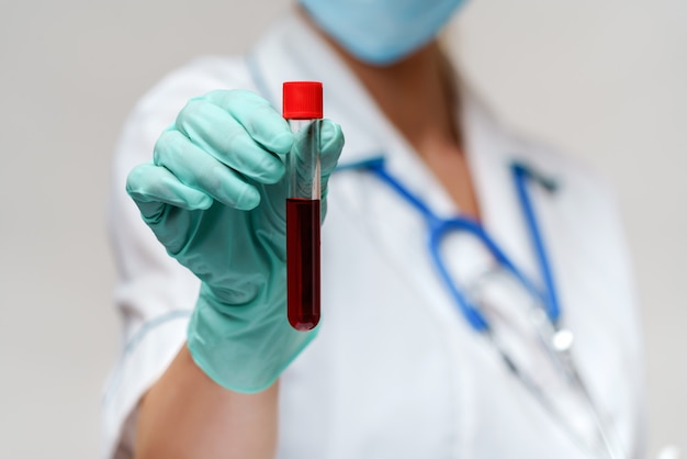 Krankenschwester mit Schutzmaske und Handschuhen und Virusblut-Reagenzglas