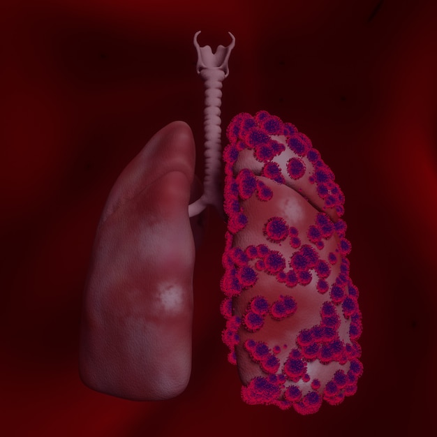 Krankheitslungen mit Covid 19, Coronavirus 2019-n, Mikroskopische Ansicht von schwimmenden Influenzaviruszellen. 3D-Rendering.