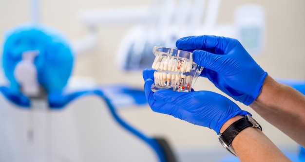 Kunststoffkiefer in der Zahnarztpraxis Der Arzt hält Zahnimplantate in den Händen Blaue Handschuhe Selektiver Fokus Closeup