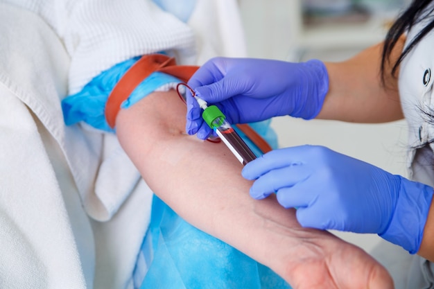 Laboratorio con enfermera tomando una muestra de sangre del paciente