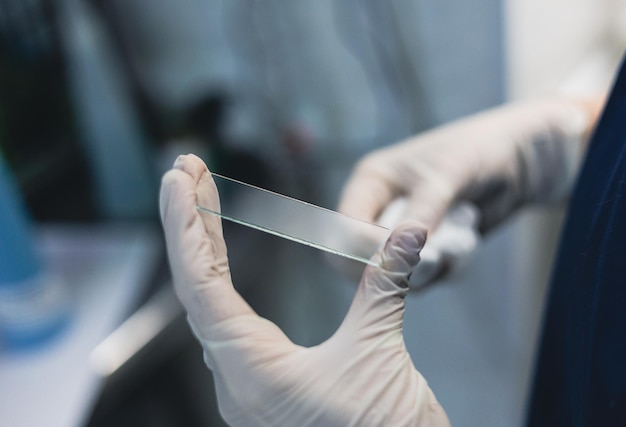 En el laboratorio, el médico hace un frotis de sangre en un portaobjetos de vidrio para su examen. Las manos de un asistente de laboratorio con guantes sostienen un vaso con un frotis de sangre para su análisis. Concepto de análisis de sangre.