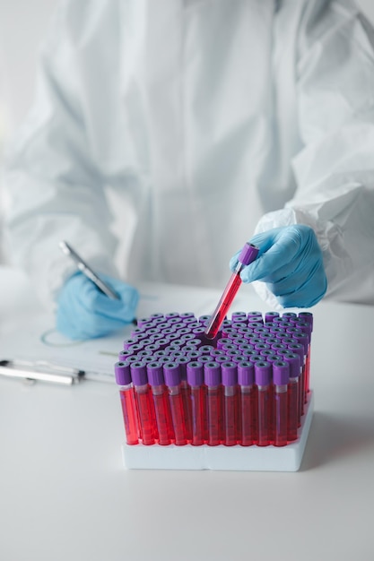 Foto el laboratorio se utiliza para la investigación científica para examinar e investigar la sangre obtenida mediante el muestreo de pacientes del asistente de laboratorio del hospital que realiza análisis de sangre para detectar anomalías conceptos de laboratorio y expertos