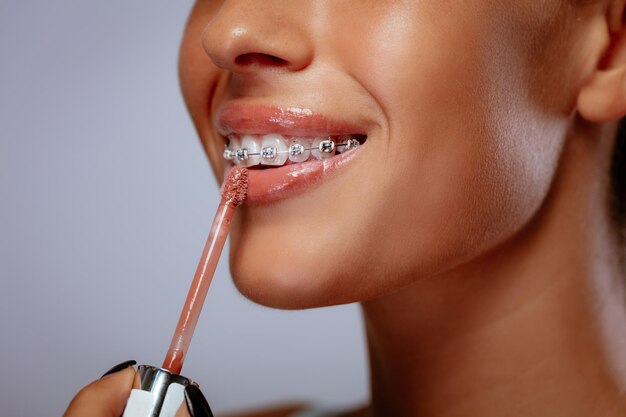 Lächelnde junge Frau mit Klammern, die Lipgloss auf ihre Lippen aufträgt.