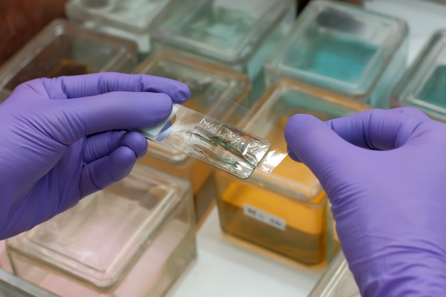 Lâmina de montagem por vidro de cobertura, lâmina de coloração Papanicolau para citologia, laboratório