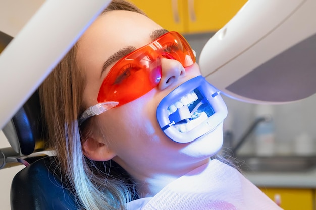 La lámpara UV brilla en los dientes del paciente durante el blanqueo de dientes en la clínica dental