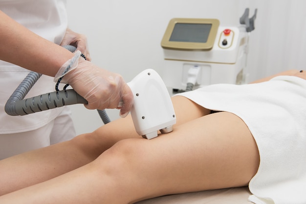 Laser-Epilation der Beine