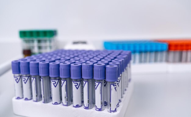 Leere Blutteströhrchen im Labor Wissenschaftliche Chemie-Forschungstechnologie