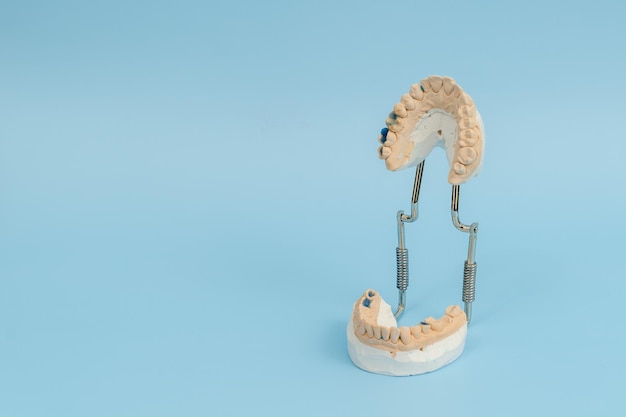Lehrmodell für Zahnmedizinstudenten, das Zahnwurzeln, Zahnfleischerkrankungen, Karies und Plaque zeigt