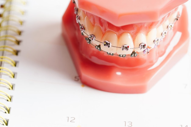 Lembrete de consulta dentária no calendário Dentes saudáveis Saúde dentária
