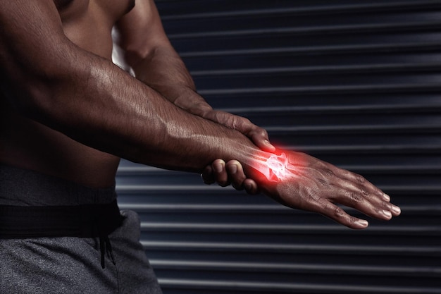 Foto se lesionó la mano disparo de un hombre irreconocible frotándose la mano lesionada durante un entrenamiento