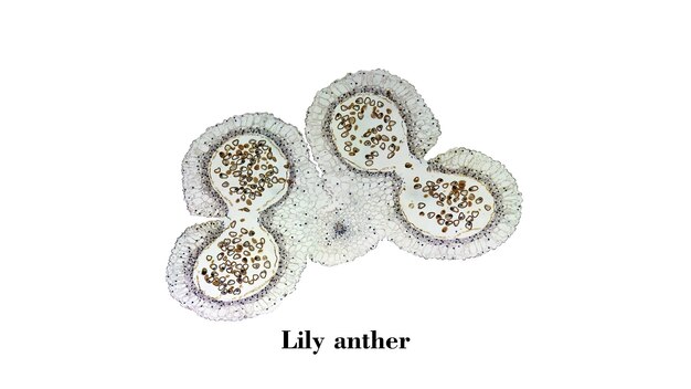 Lily Anthere mikroskopische Aufnahme