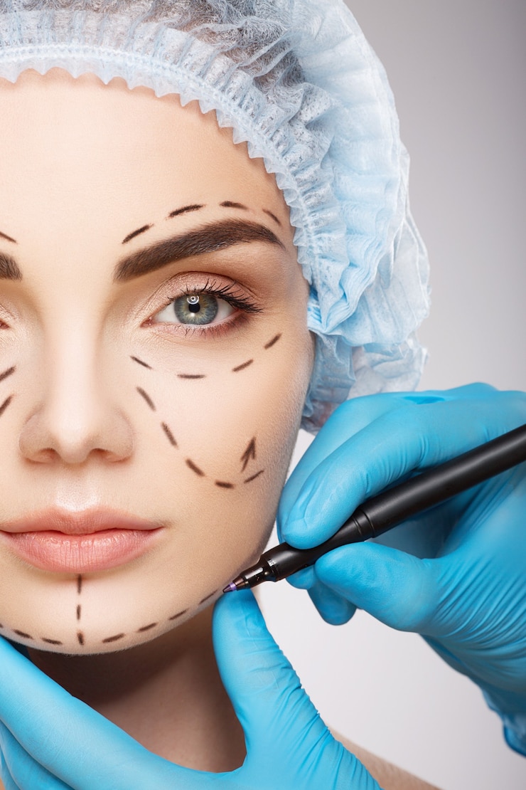 Foto linda garota com sobrancelhas escuras, usando chapéu azul médico na parede, as mãos do médico usando luvas azuis desenhando linhas de perfuração no rosto, conceito de cirurgia plástica.