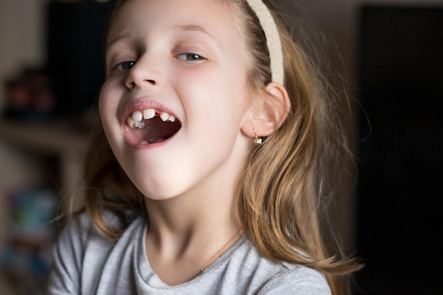 Linda garotinha de 67 anos perdeu o primeiro dente de leite perda dos dentes decíduos substituição dos dentes permanentes odontologia infantil lindos dentes infantis