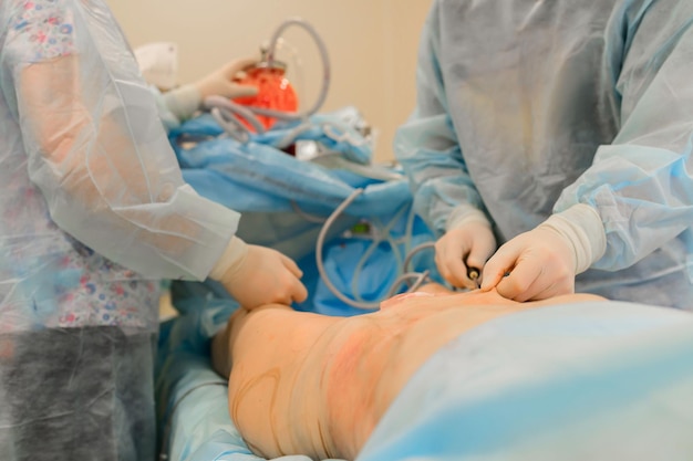 Lipoaspiração de cirurgia plástica O processo de remoção de gordura nas pernas de uma mulher gorda Sem rosto paciente irreconhecível