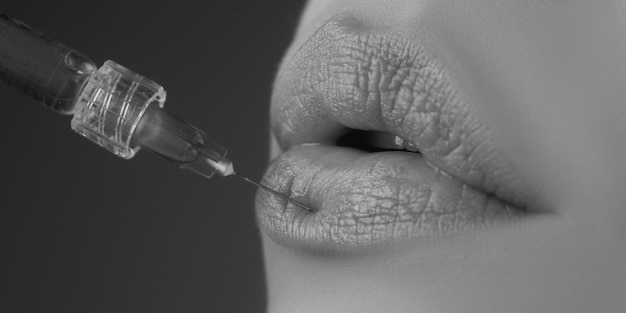 Lippenvergrößerung Spritze weiblicher Mund Hyaluronsäure-Injektion Altersveränderungen Kosmetologie Behandlung