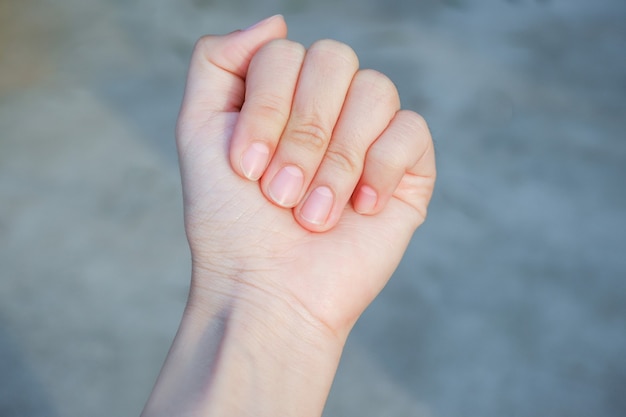 Lunula auf Fingernägeln Half Moon kann auf Verdauungsprobleme bei Bluthochdruck hinweisen