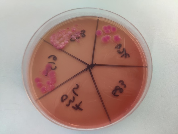 Foto macconkey-agar-medium-plattenwachstum von escherichia coli-bakterienkolonien