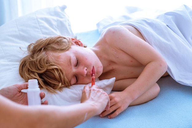 Mãe de alto ângulo dando seringa com xarope para criança dormindo com varicela dormindo na cama no quarto iluminado pelo sol em casa