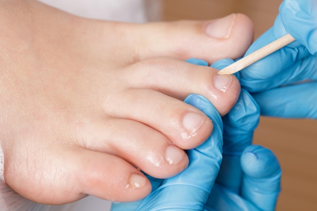 El maestro de pedicura procesa la cutícula de los dedos de los pies con un palo de madera.