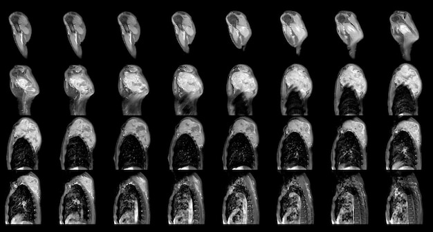 Magnetresonanztomographie des Schultertumors oder Massenwissenschaft und Bildung MRT-Schulterhintergrund