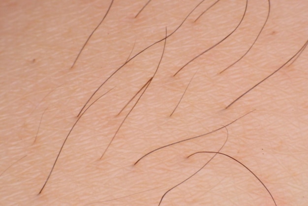 Makro-Aufnahme von menschlicher Haut mit Haaren