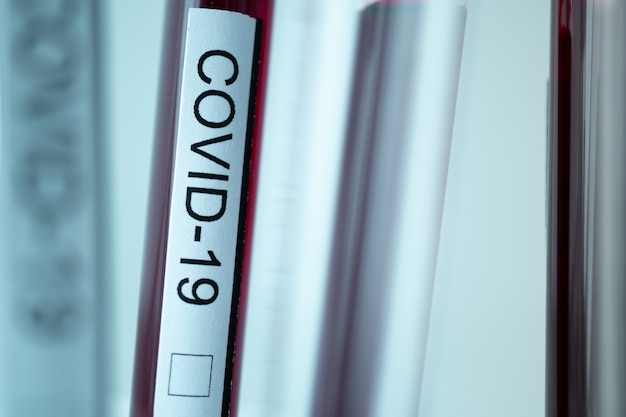 Foto makroaufnahme eines covid-19- oder coronavirus-etiketts auf einem kunststoffröhrchen, labortests zur erfindung von pandemiemedikamenten