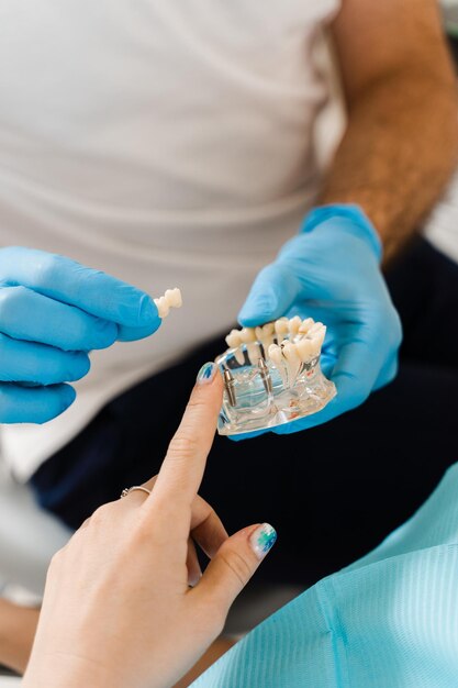 Mandíbula de plástico artificial com implantes dentários closeup Próteses e implantes dentários Consulta de próteses dentárias com dentista para mulher paciente em odontologia