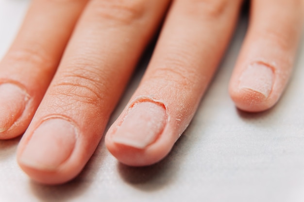 Maniküre-Prozess. Nagelhaut am Fingernagel.