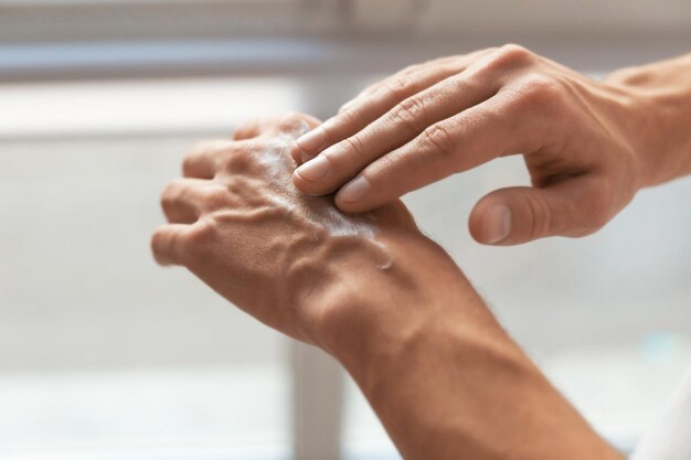 Mann, der Handcreme in der Nähe aufträgt