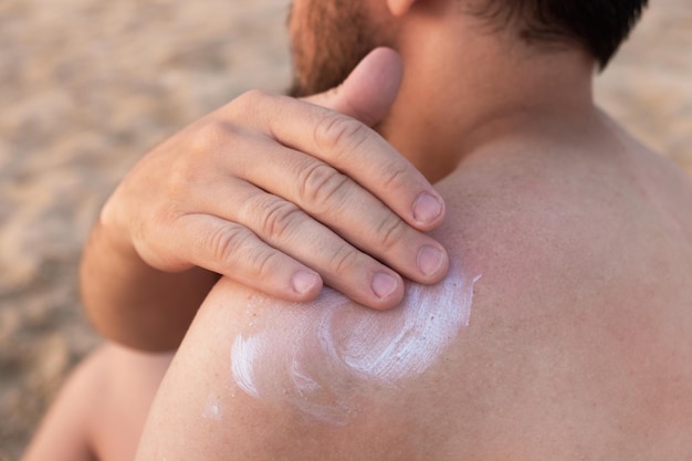 Mann, der im Strandurlaub Sonnenschutzcreme auf die Schultern aufträgt SPF-Sonnenschutz