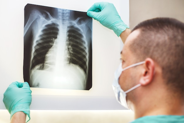 Mannhand, die eine Lungenradiographie lokalisiert auf einem weißen Hintergrund hält