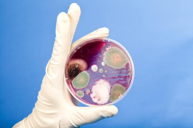 Mano de científicos sosteniendo una placa de Petri con bacterias
