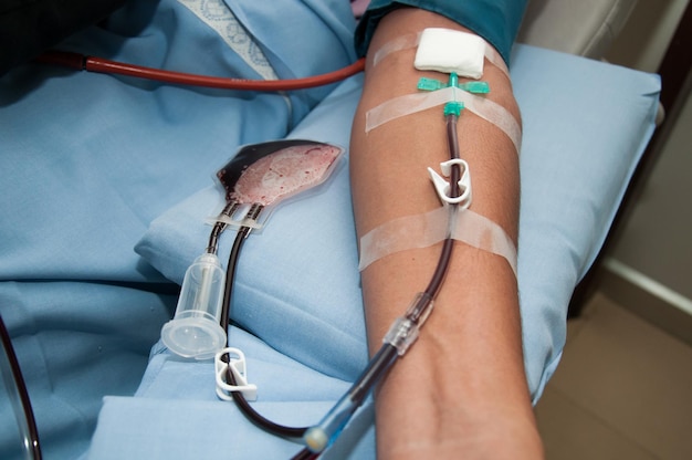Mano cortada del paciente con goteo intravenoso en la cama