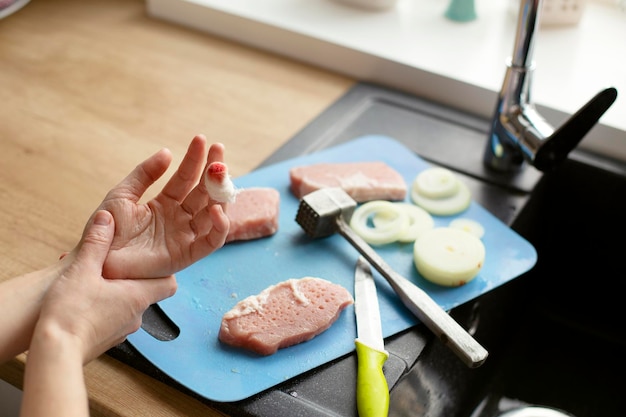 Una mano con un dedo vendado en el fondo de una tabla con comida y un cuchillo