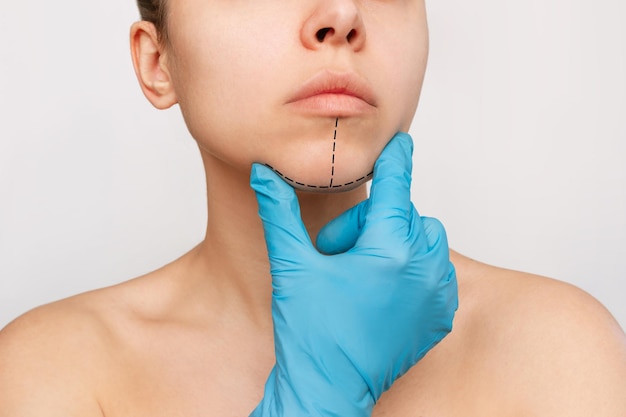 La mano enguantada del doctor sostiene la cara de la mujer mostrando marcas en la barbilla sobre un fondo blanco