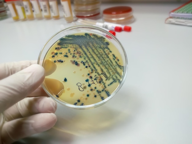 Mano enguantada de un técnico o científico sosteniendo una placa de petri en el fondo del laboratorio de microbiología