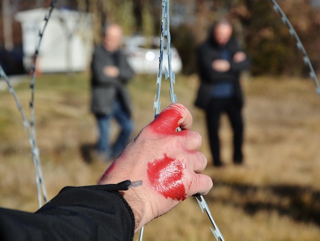 Foto mano ensangrentada cortada de un refugiado sosteniendo alambre de afeitar de pie en el campo