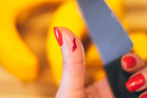Mano femenina con manicura roja sostiene cuchillo con mano herida, tabla de cortar con calabaza