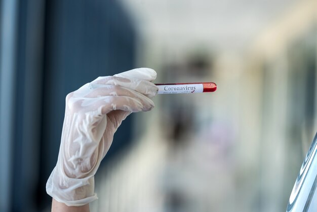 Mano femenina que sostiene el tubo de ensayo con sangre positiva marcada corona covid19. Ciencias