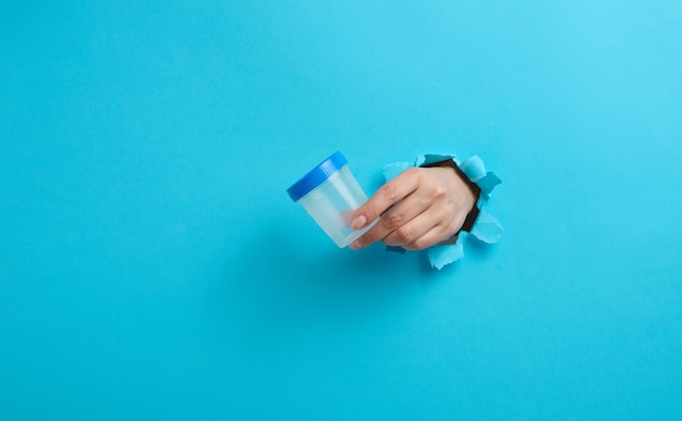 Mano femenina sostiene un frasco de plástico vacío para análisis de orina, la mano sobresale de un agujero rasgado en un fondo azul.