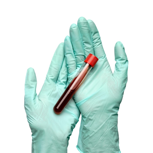 Mano en guante de látex con muestra de sangre en tubo de ensayo cerca aislado sobre fondo blanco.