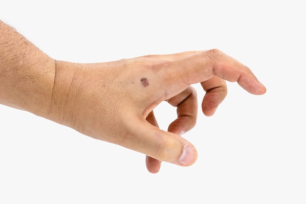 mano masculina seca y con manchas en la piel problema dermatológico melanosis solar comenzando piel sin protector solar aislado sobre fondo blanco