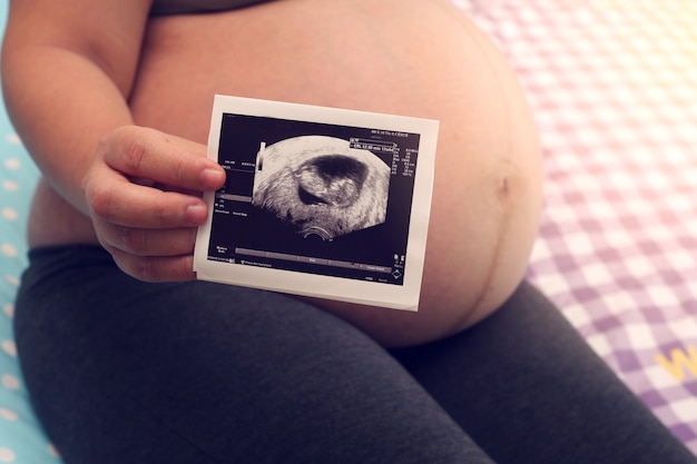 Foto mano de mujer embarazada con ecografía.