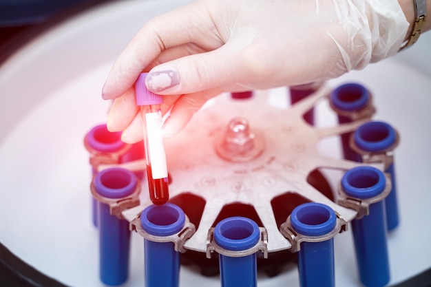 Mano de mujer en guante azul poniendo muestras de sangre en una centrífuga en laboratorio Mujer investigadora está colocando tubos de ensayo en la máquina especial