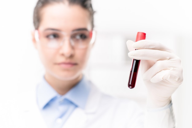 Mano de mujer joven médico en guantes sosteniendo matraz con análisis de sangre mientras trabaja en el laboratorio de la clínica