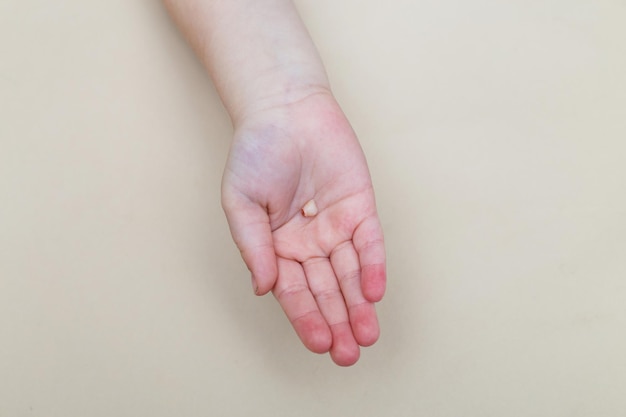 La mano de la niña sosteniendo y mostrando su diente frontal de leche caído de cerca