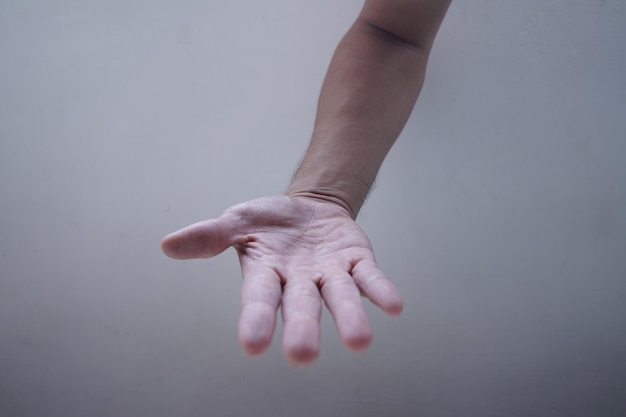 una mano que ha dado ayuda a otros